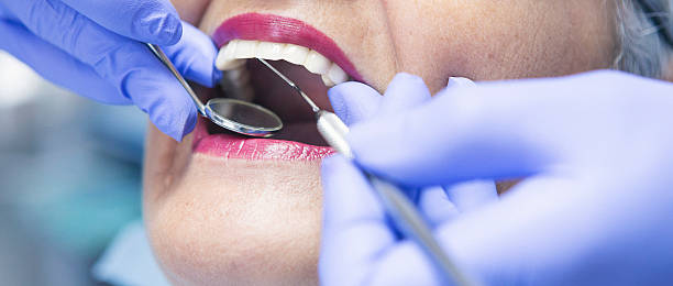 Best Emergency Dental Care for Broken or Chipped Teeth in Bangor, WI